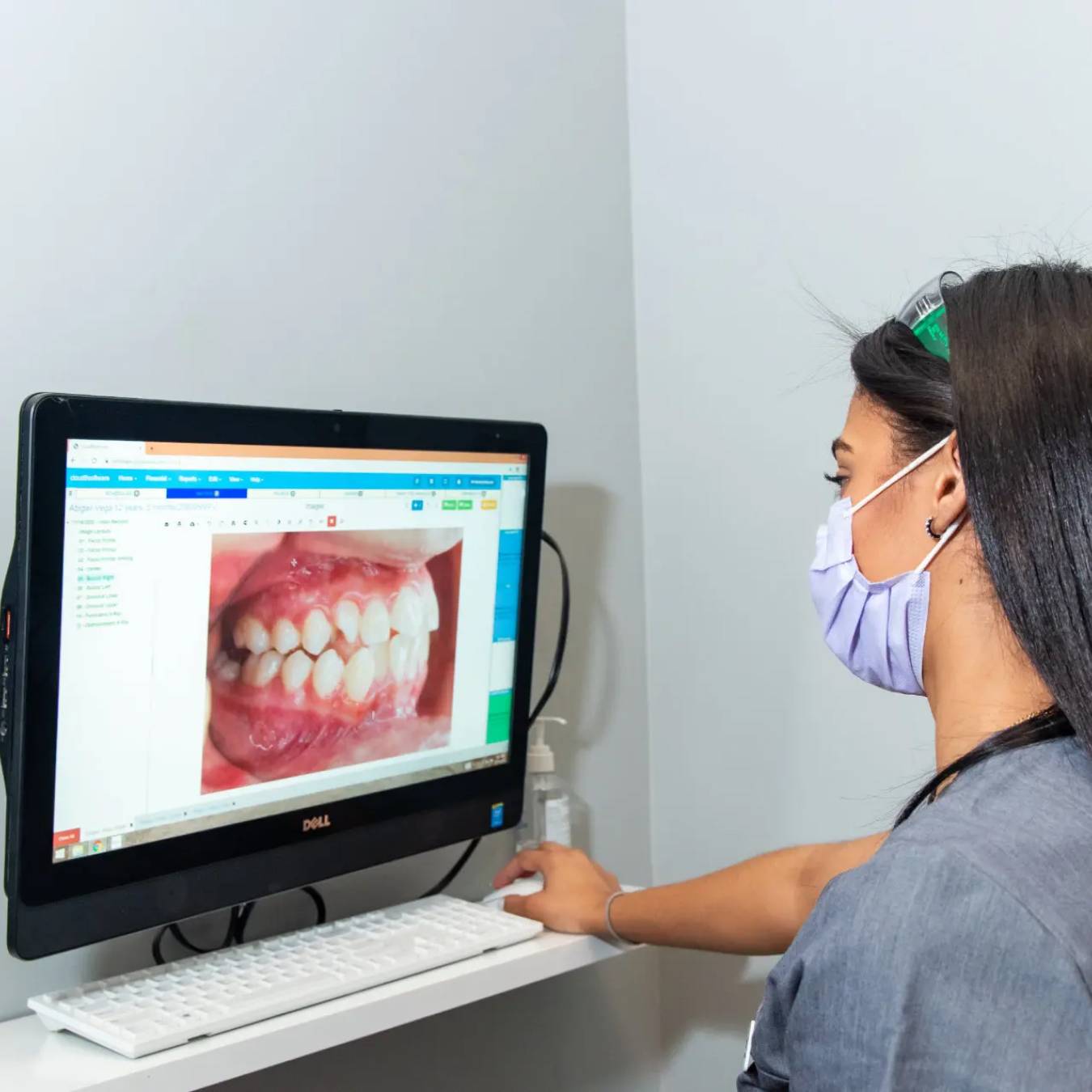 Team member examining a patients teetho on the computer