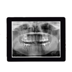 Digital x-rays