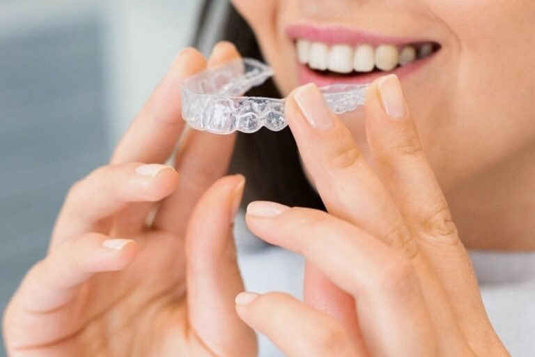 Affordable Invisalign and Clear Aligner Solutions for Confident Smiles
